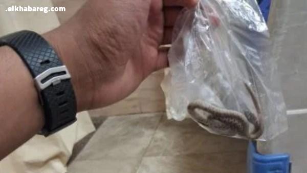 مواطن يصطحب ثعبانا لدغه لمستشفى قنا
